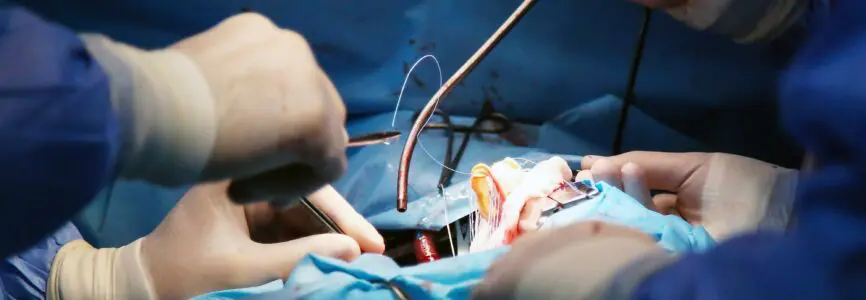 We work with a valve. Valve Replacement. Heart surgery.