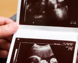 woman's hands with ultrasound