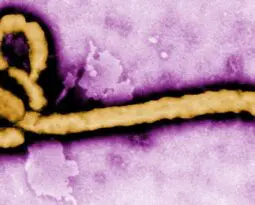 yellow strand of ebola on a purple background