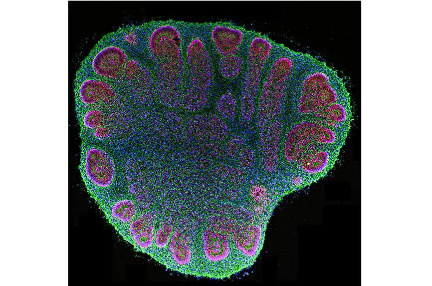 image of a brain organoid.