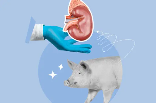 a pig, a kidney, a latex glove, collage
