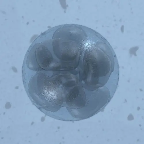 human embryo