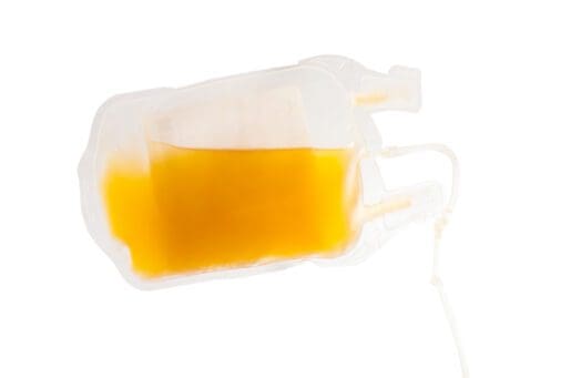 clear plastic medical bag with yellow liquid, laying horizontally