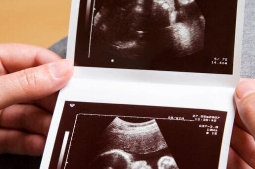 woman's hands with ultrasound