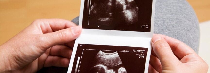 woman's hands with ultrasound