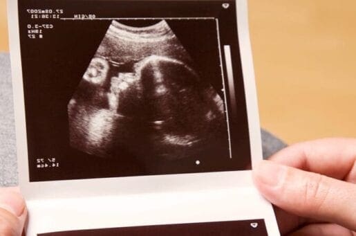 hands holding ultrasound photo