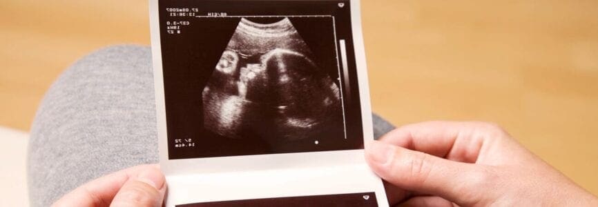 hands holding ultrasound photo