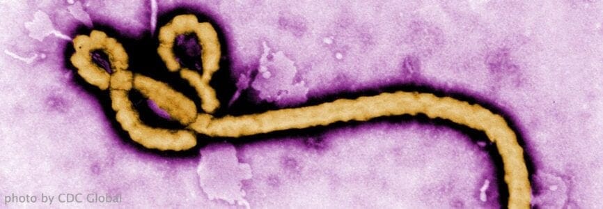 yellow strand of ebola on a purple background