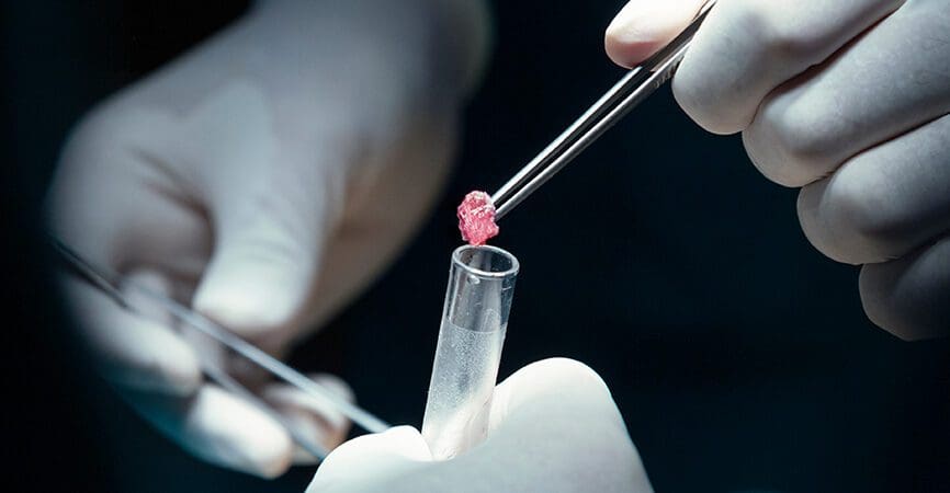black and white photo of hand with tweezers and test tube