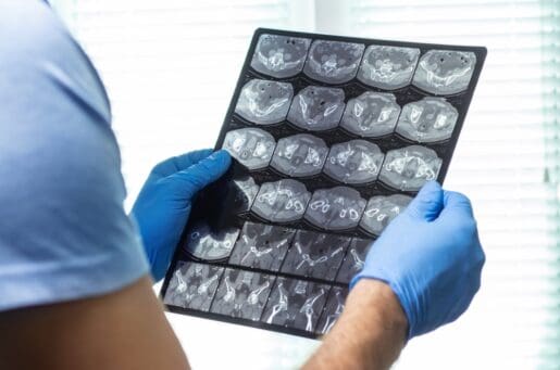 doctor holding pet scan of brain