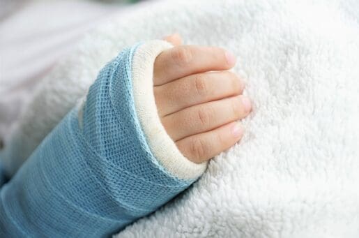 child's broken arm in cast