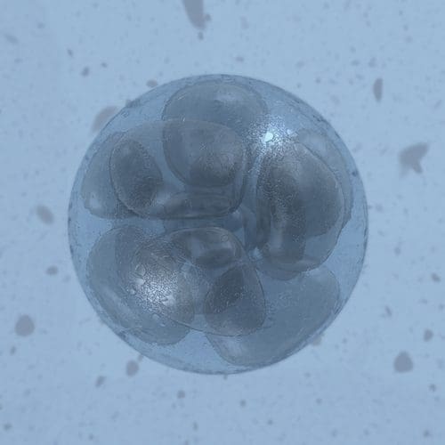 human embryo