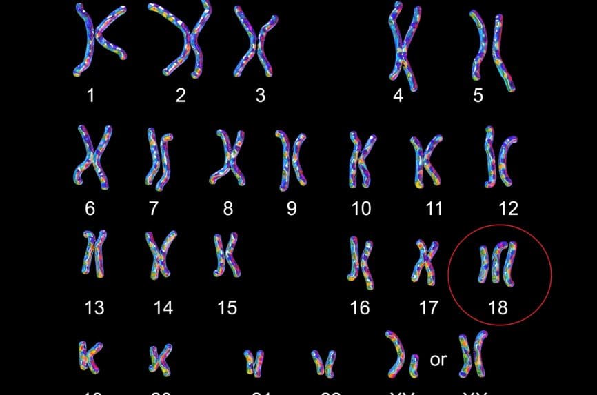 genetic abnormality images